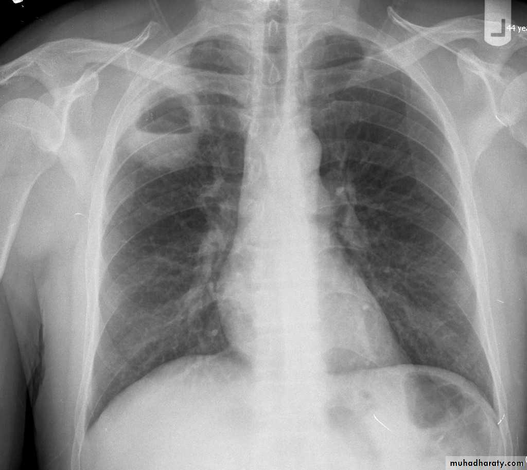 Chest Imaging