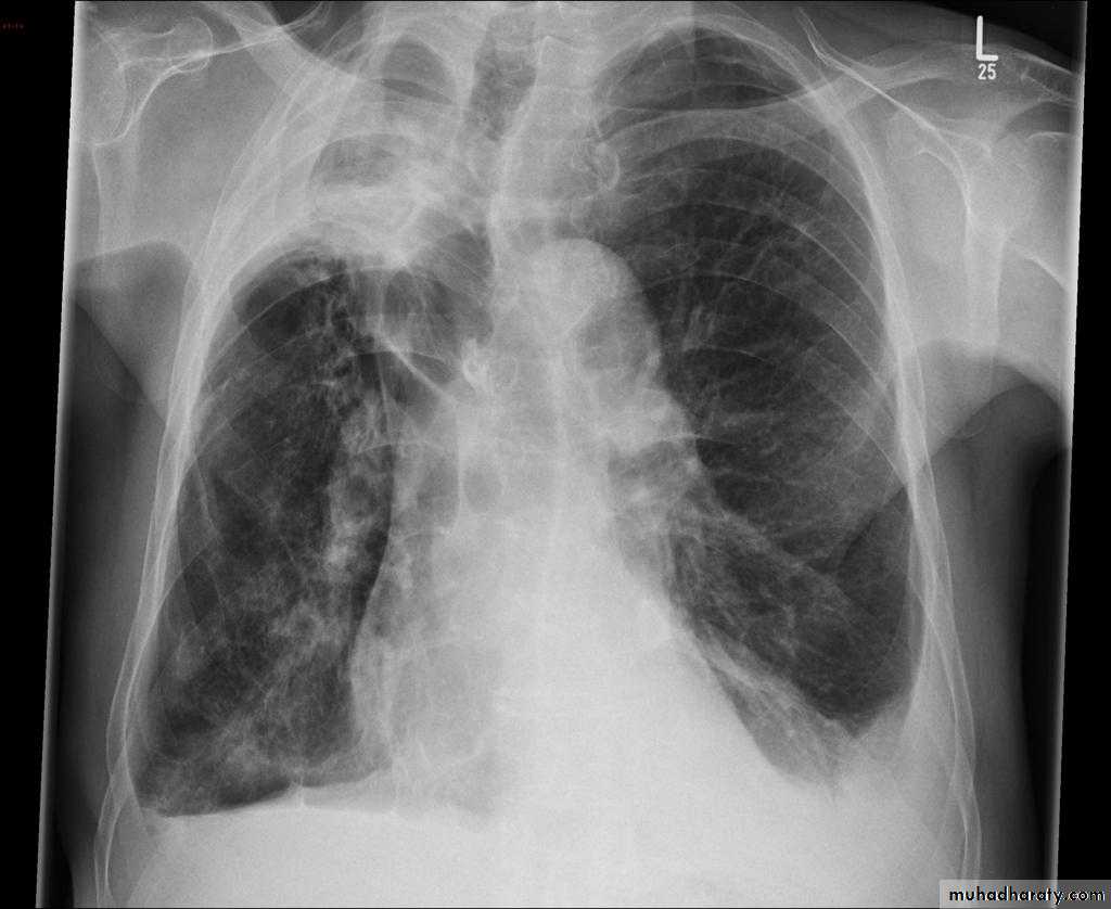Chest Imaging