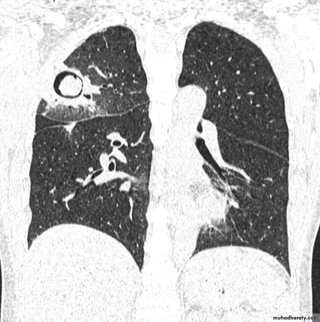 Chest Imaging