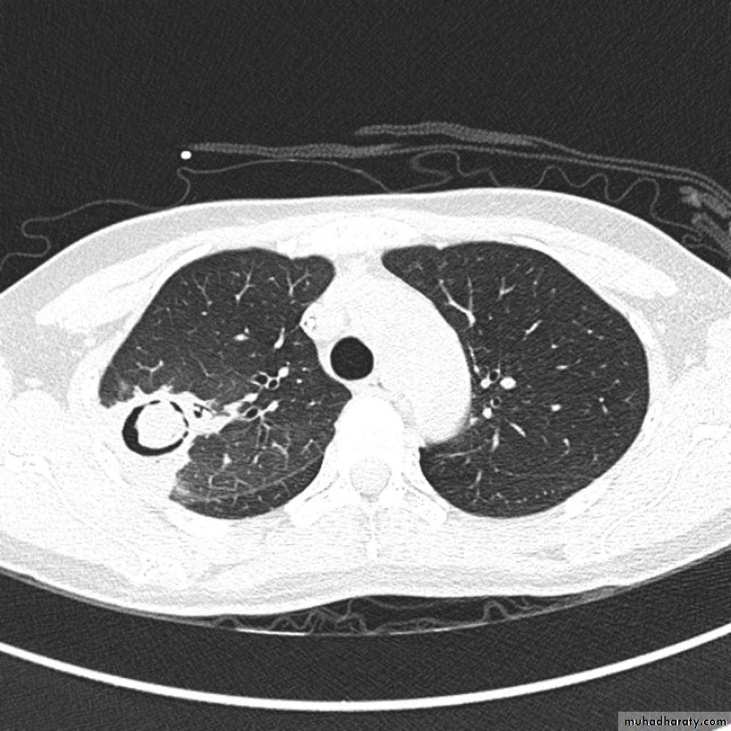 Chest Imaging
