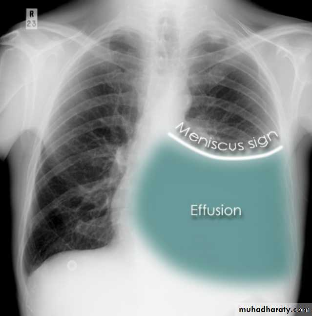 Chest Imaging