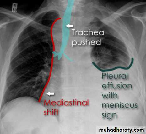 Chest Imaging
