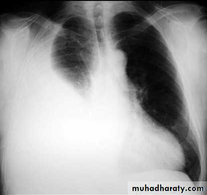 Chest Imaging