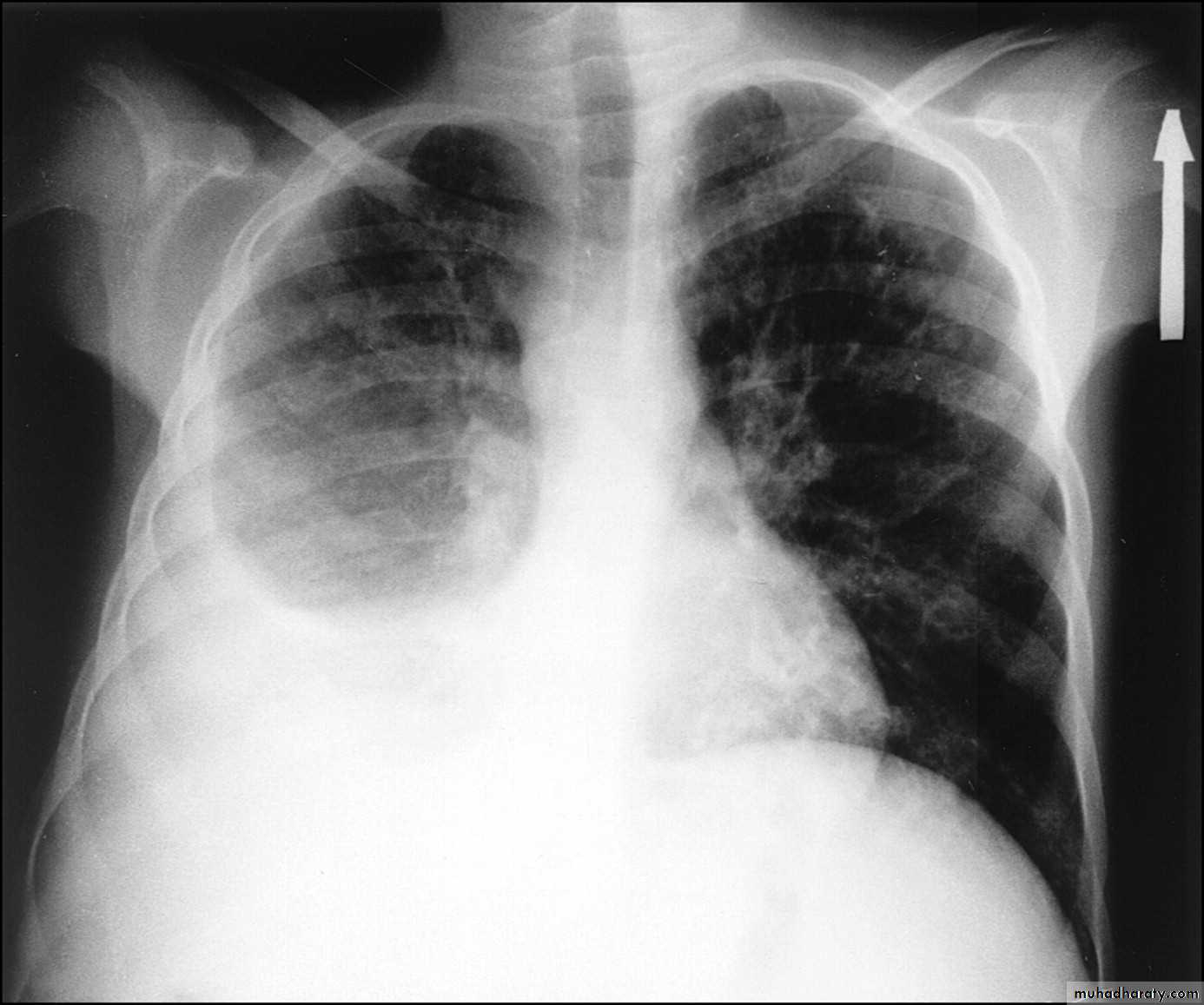 Chest Imaging