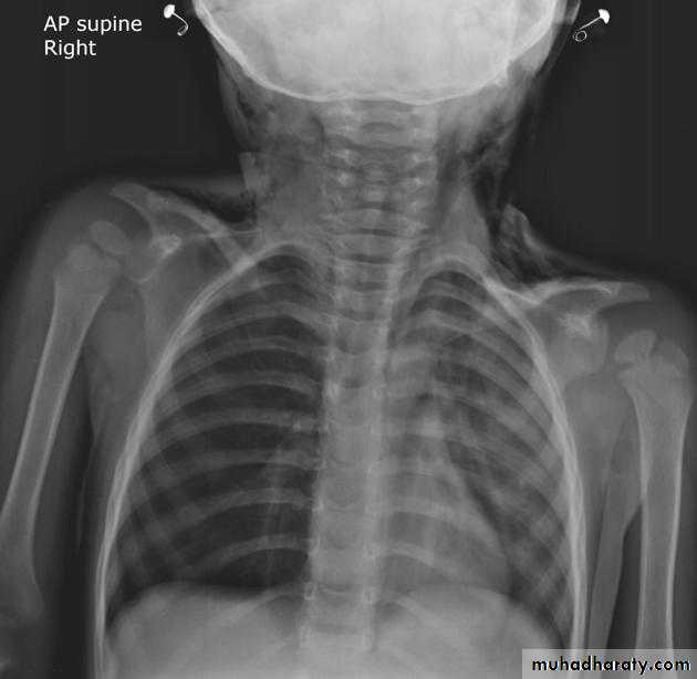 Chest Imaging