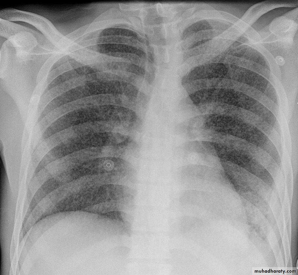 Chest Imaging