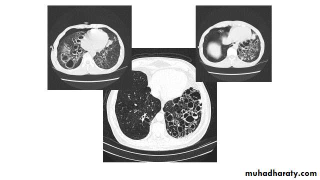 Chest Imaging