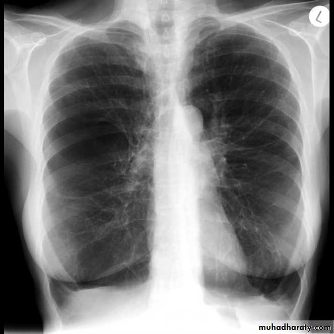 Chest Imaging