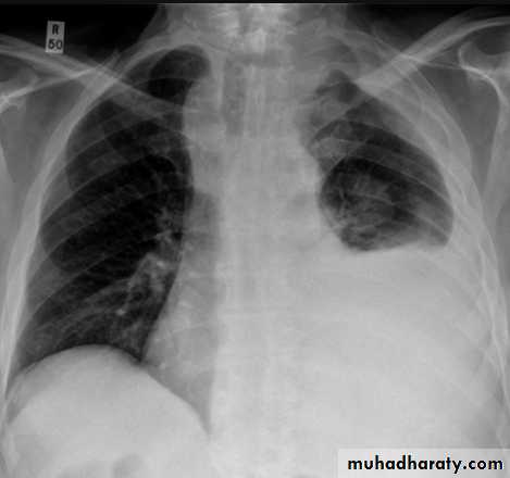 Chest Imaging
