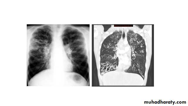 Chest Imaging