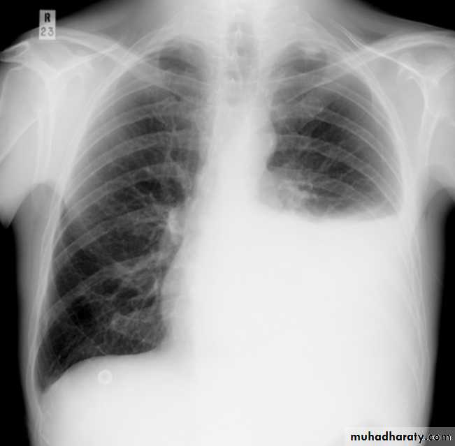 Chest Imaging
