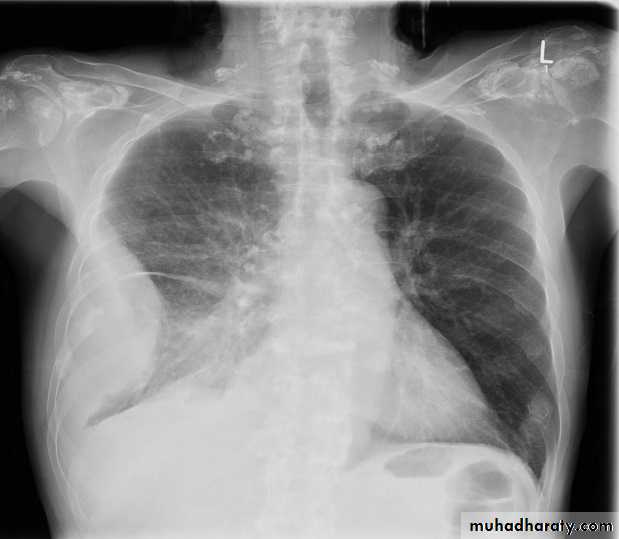 Chest Imaging