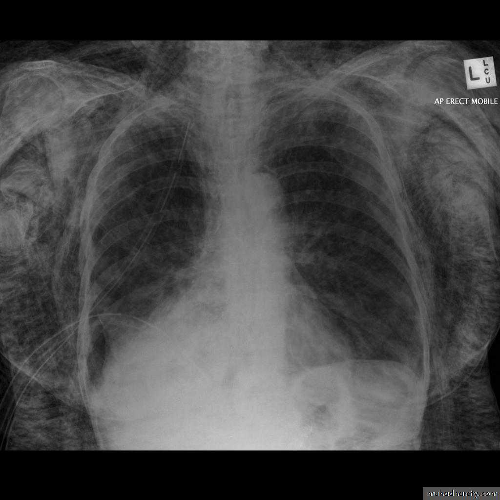 Chest Imaging