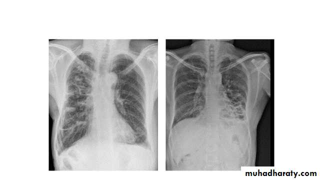 Chest Imaging