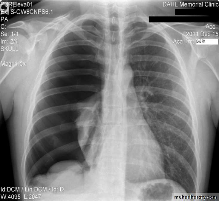 Chest Imaging