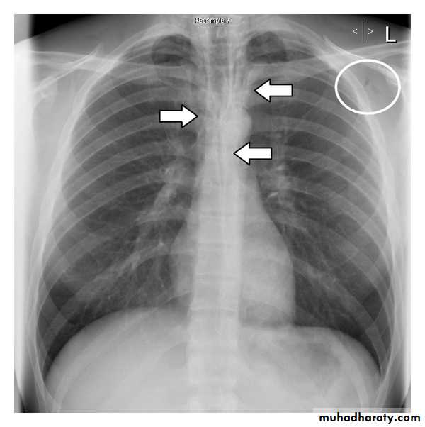 Chest Imaging