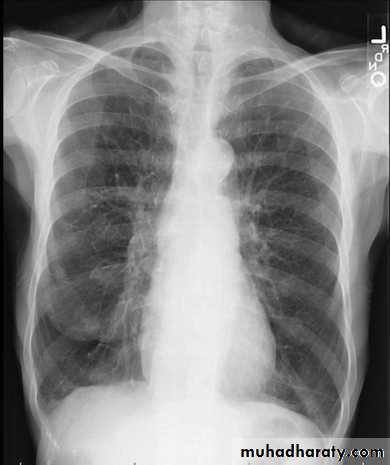 Chest Imaging