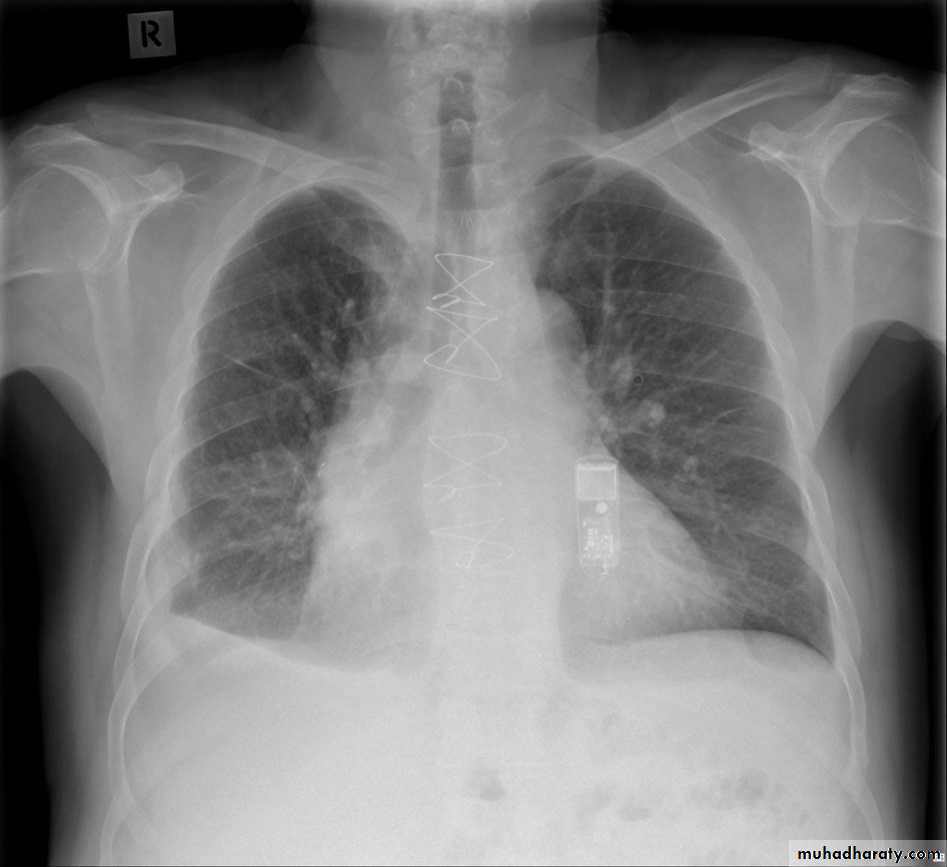 Chest Imaging