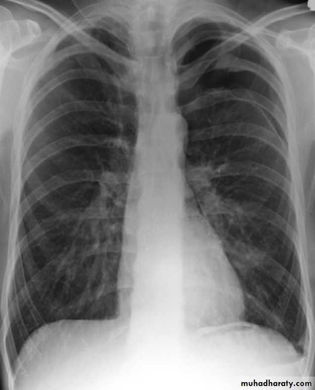Chest Imaging