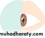 Ophthalmology Lecture Notes