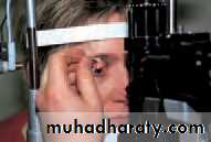 Ophthalmology Lecture Notes