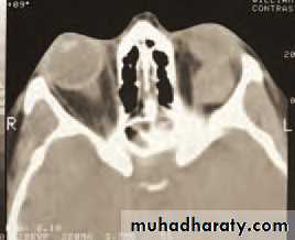 Ophthalmology Lecture Notes