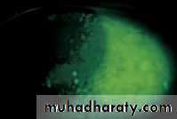 Ophthalmology Lecture Notes