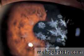 Ophthalmology Lecture Notes