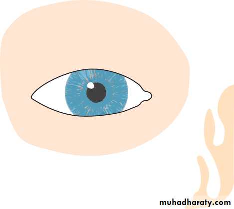 Ophthalmology Lecture Notes
