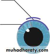 Ophthalmology Lecture Notes