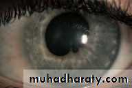 Ophthalmology Lecture Notes