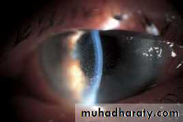 Ophthalmology Lecture Notes