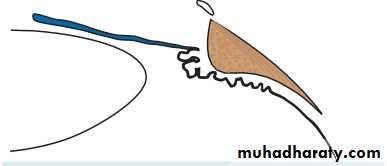 Ophthalmology Lecture Notes