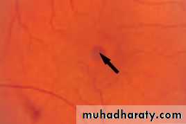Ophthalmology Lecture Notes