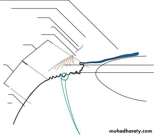 Ophthalmology Lecture Notes