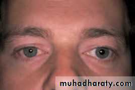 Ophthalmology Lecture Notes