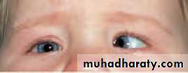 Ophthalmology Lecture Notes