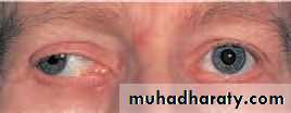 Ophthalmology Lecture Notes