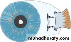 Ophthalmology Lecture Notes