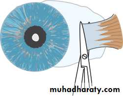 Ophthalmology Lecture Notes