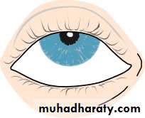 Ophthalmology Lecture Notes