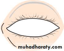 Ophthalmology Lecture Notes