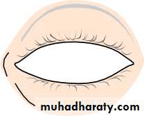 Ophthalmology Lecture Notes
