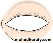 Ophthalmology Lecture Notes