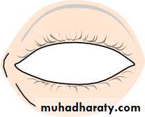 Ophthalmology Lecture Notes