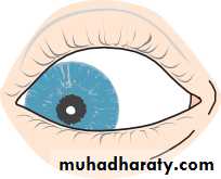 Ophthalmology Lecture Notes