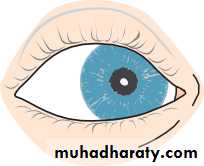 Ophthalmology Lecture Notes