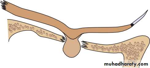 Ophthalmology Lecture Notes