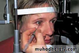 Ophthalmology Lecture Notes