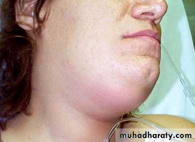 The pharynx